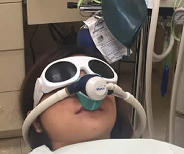 Nitrous Oxide Sedation Dentistry