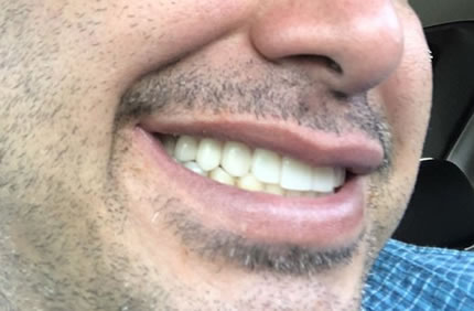 dental patient smile after