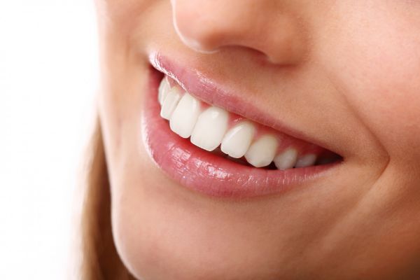 Smile Makeover: The Top 5 Cosmetic Dentistry Procedures for a Brilliant Smile